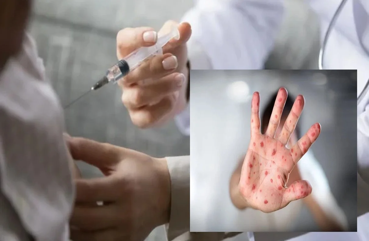 North Dakota Reports First Measles Case In 14 Years